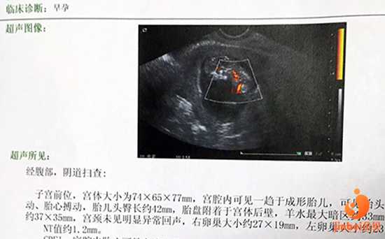 梅州代孕美女卵子_梅州哪有愿意代孕的个人_【昆华医院做供卵试管婴儿吗】和