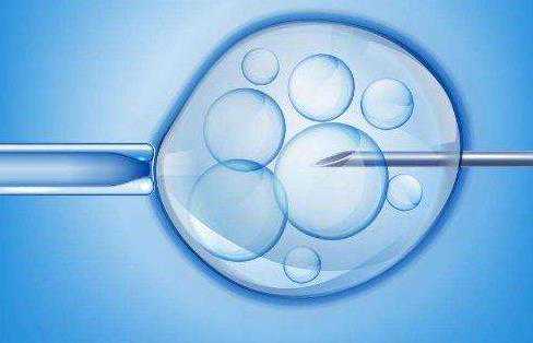 第几代试管可以选性别_试管婴儿促排方案如何选择_喜得宝助孕｜二代试管和三